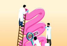 Colorectal Cancer: An Often Silent Scourge